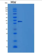 人IL18RAP / IL1R7重组蛋白His tag