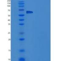 大鼠肝配蛋白A受体4(EPHA4)重组蛋白His tag