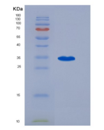 人磷酸二酯酶9A(PDE9A)重组蛋白