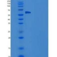 人β淀粉酶重组蛋白His Tag