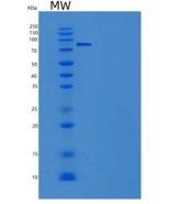 人SGK3 / SGKL重组蛋白His & GST tag