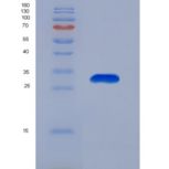 人胱天蛋白酶14(CASP14)重组蛋白