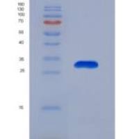 人胱天蛋白酶14(CASP14)重组蛋白