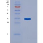 人磷酸二酯酶9A(PDE9A)重组蛋白