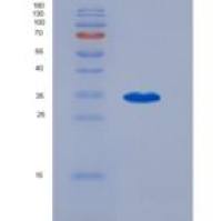 人磷酸二酯酶9A(PDE9A)重组蛋白