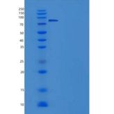 人SGK3 / SGKL重组蛋白His & GST tag