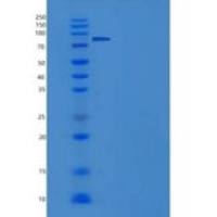 人SGK3 / SGKL重组蛋白His & GST tag