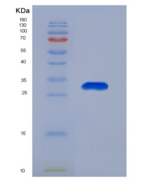 人胱天蛋白酶14(CASP14)重组蛋白
