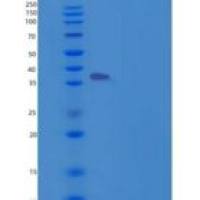 人HOXA1重组蛋白His tag