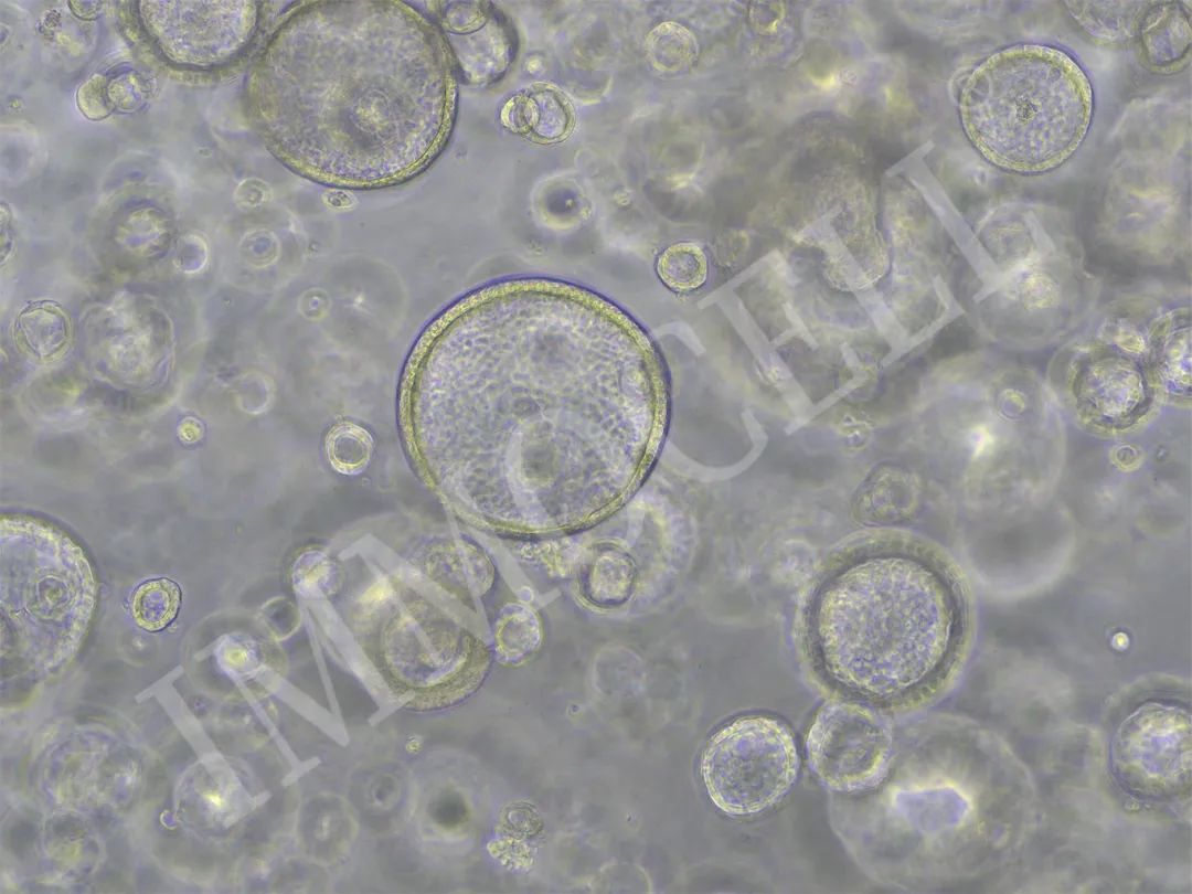 逸漠生物iPSC诱导肺类器官产品