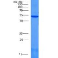 小鼠SCPEP1 / RISC重组蛋白His Tag