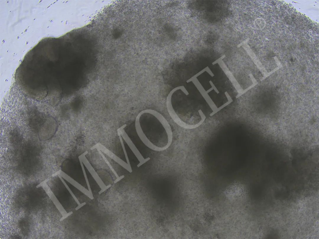 逸漠生物iPSC诱导肺类器官产品