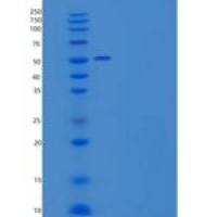 人岩藻糖基转移酶10(FUT10)重组蛋白His tag