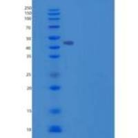 人ILKAP重组蛋白His tag