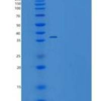 人CHST11 / C4ST-1重组蛋白His tag
