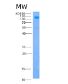 人IGSF3 / EWI-3重组蛋白His tag