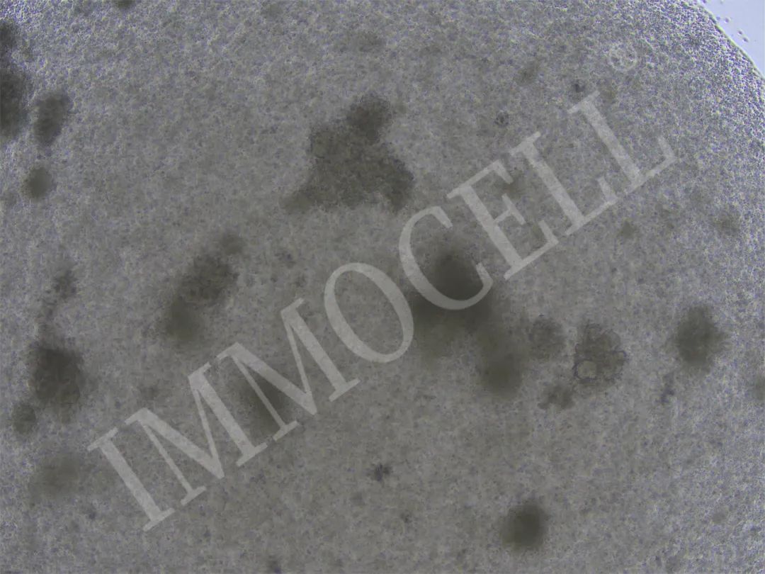 逸漠生物iPSC诱导肺类器官产品