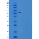 小鼠软骨凝集蛋白(CHODL)重组蛋白Fc tag