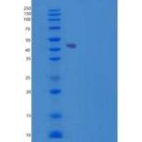 小鼠软骨凝集蛋白(CHODL)重组蛋白Fc tag