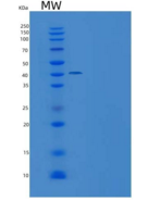 人NCR3 / NKp300重组蛋白His & Fc tag