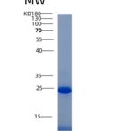 人干扰素γ诱导蛋白30(IFI30)重组蛋白His tag
