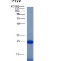 人干扰素γ诱导蛋白30(IFI30)重组蛋白His tag