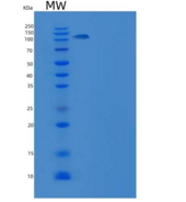 人补体成分6(C6)重组蛋白His tag