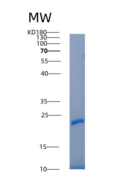 人白细胞介素-22BP重组蛋白His Tag