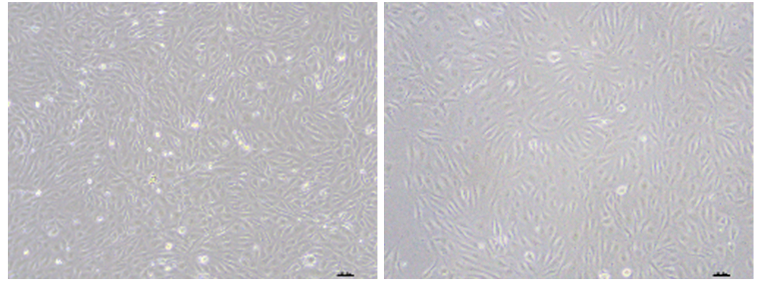 人脐静脉内皮细胞（HUVEC）原代分离、鉴定及培养
