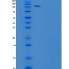 人信号素5A(SEMA5A)重组蛋白His tag