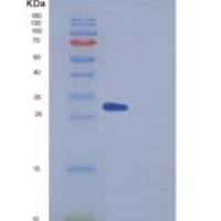 小鼠Factor D重组蛋白His Tag