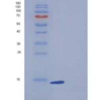 人BLBP / FABP7重组蛋白