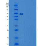 小鼠SPN / CD43重组蛋白Fc tag