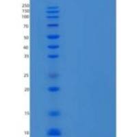 小鼠CXCL3 / GRO重组蛋白His Tag