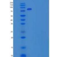 人NAALADL1重组蛋白His tag