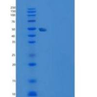 人TERF1 / TRF1重组蛋白His tag