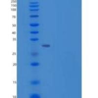 人CD34分子(CD34)重组蛋白His tag