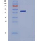 人羧肽酶B1(CPB1)重组蛋白His tag