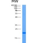 人Ube2L6重组蛋白His Tag