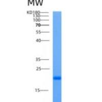 人Ube2L6重组蛋白His Tag