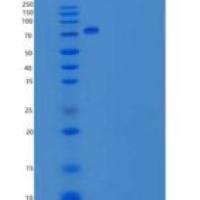 人神经连接蛋白3(NLGN3)重组蛋白His tag