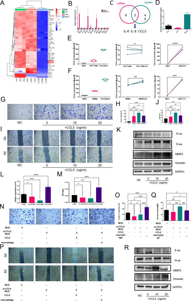 LabEx Luminex平台助力脊索瘤的肿瘤微环境研究