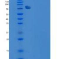 人PDE2A / CGS-PDE重组蛋白aa 215-900, His tag