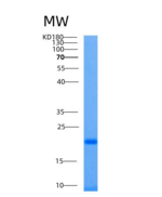 人Ube2L6重组蛋白His Tag