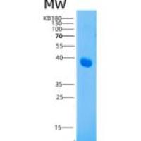 人CD208 / LAMP3 / DC-LAMP重组蛋白His tag