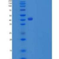 人SerpinB6 / PI-6重组蛋白His tag