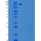 人PKC nu / PRKD3重组蛋白GST tag