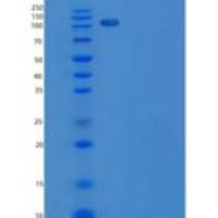 人PKC nu / PRKD3重组蛋白GST tag