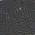 人眼小梁网细胞,HTMC