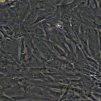 人眼小梁网细胞,HTMC